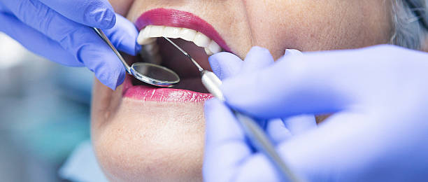 Best Chipped Tooth Repair Near Me  in Bay Point, CA